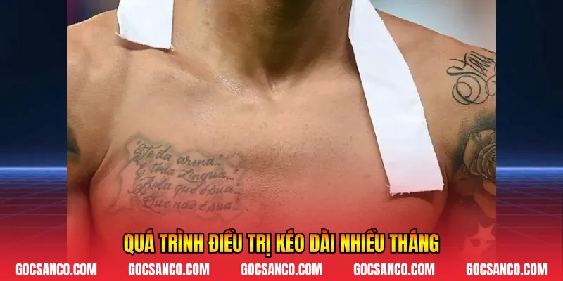 Quá trình điều trị kéo dài nhiều tháng